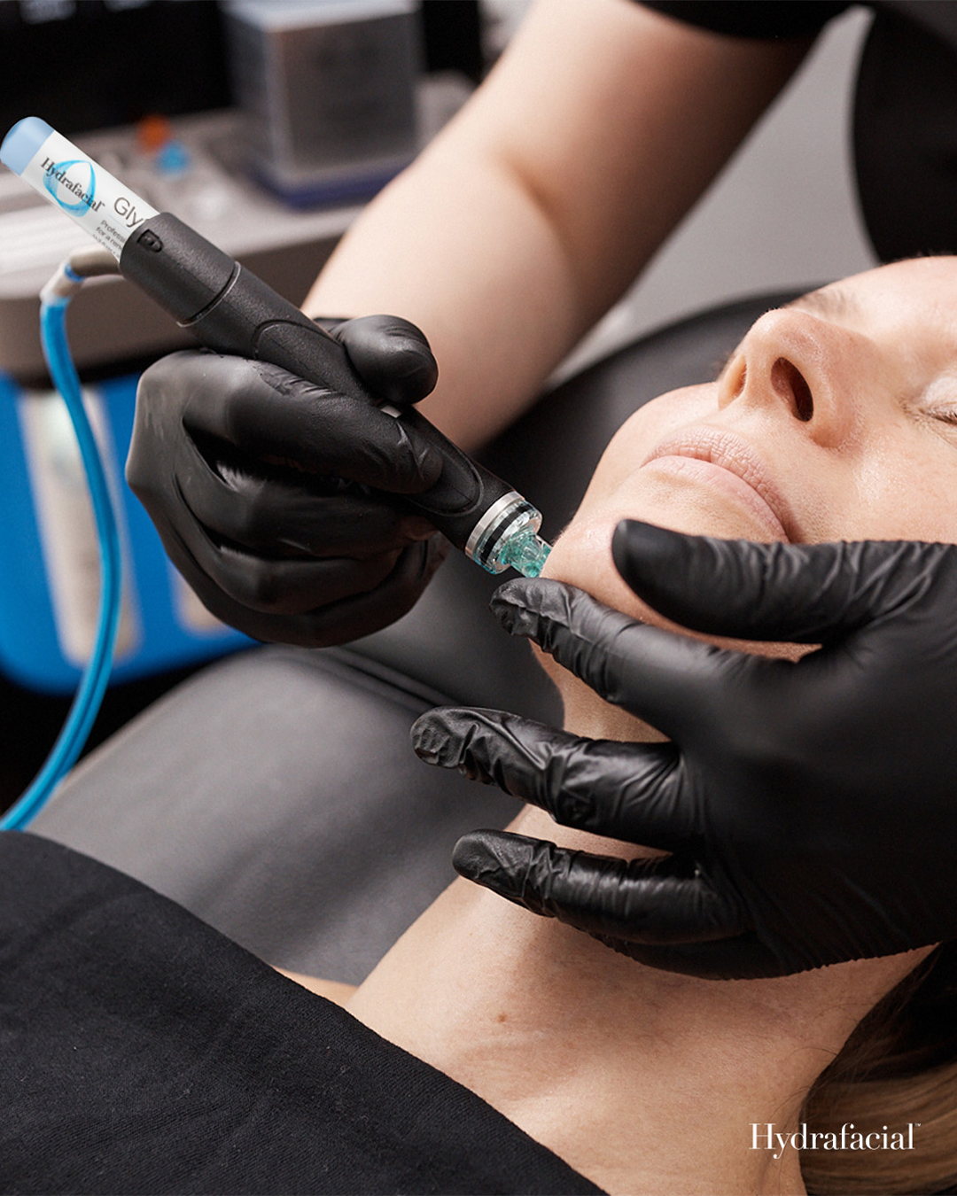 Licensed esthetician performing a HydraFacial treatment at EBSKIN in San Diego